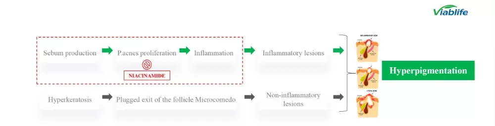 Nicotinamide nei cosmetici: controllo efficace del sebo e soppressione dell'acne