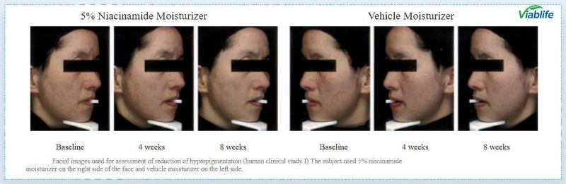 Nicotinamide per schiarire la pelle Nicotinamide for Skin Brightening