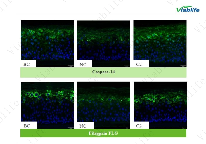 Sodium Lauryl Sulfate–Induced Barrier Damage